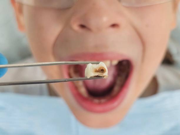 Best Urgent Care for Lost Fillings or Crowns in South Temple, PA